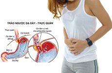 Bệnh trào ngược dạ dày thực quản k21 là gì? Nguyên nhân và cách điều trị